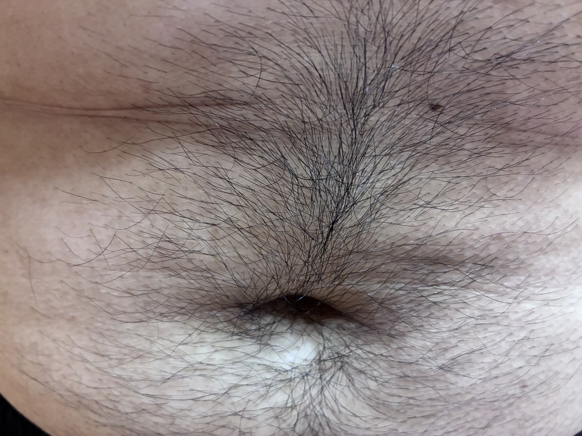 へそ周りの体毛を接写した写真