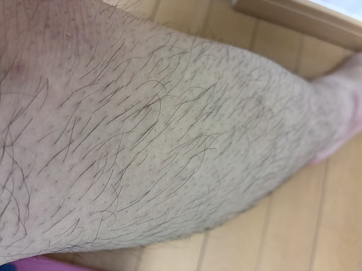 すねの体毛を接写した写真