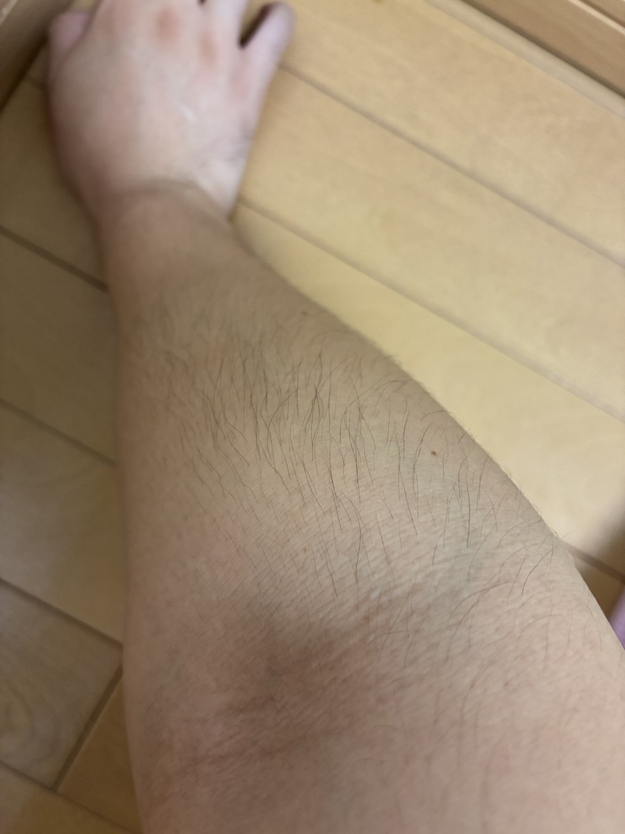 腕の体毛を接写した写真