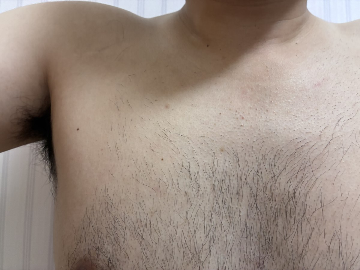 脇から胸にかけての体毛を接写した写真